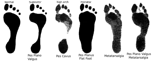 Supplied footprint comparison chart showing different footprint patterns and labels